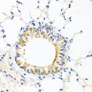 Anti-COQ7 Antibody