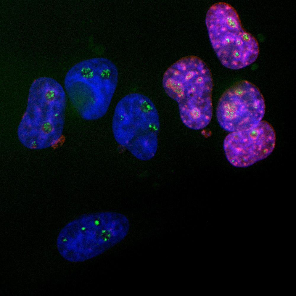 Anti-Ki67 Antibody