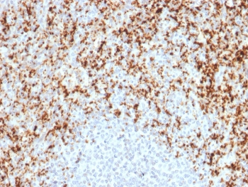 IHC testing of FFPE human spleen with ITGB3 antibody. Required HIER: boil tissue sections in 10mM Tris with 1mM EDTA, pH9, for 10-20 min followed by cooling at RT for 20 min.