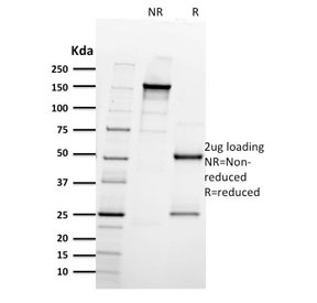 SDS-PAGE analysis of purified, BSA-free ITGB3 antibody as confirmation of integrity and purity.