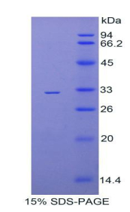 Figure. SDS-PAGE