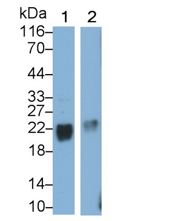 Western Blot; Sample: Lane1: Porcine Cerebrum lysate; Lane2: Rat Cerebrum lysate Primary Ab: 0.1µg/ml Rabbit Anti-Human STMN2 Antibody Second Ab: 0.2µg/mL HRP-Linked Caprine Anti-Rabbit IgG Polyclonal Antibody (Catalog: SAA544Rb19)