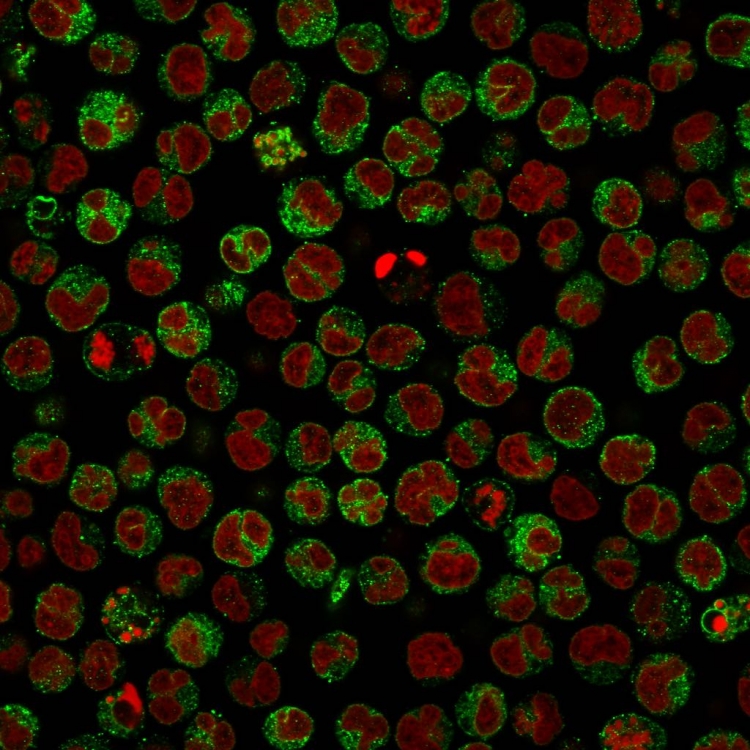 Anti-CD79a Antibody [IGA/764]
