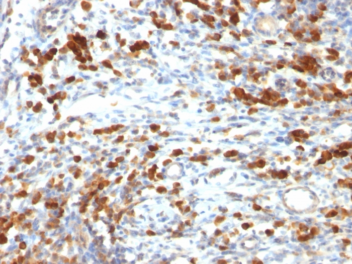 Anti-CD79a Antibody [IGA/764]