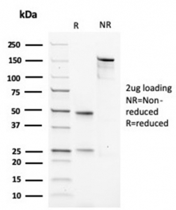 SDS-PAGE analysis of purified, BSA-free Muscle Actin antibody (clone rMSA/953) as confirmation of integrity and purity.