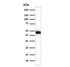 Western blot testing of human skeletal muscle tissue lysate using Muscle Actin antibody (clone rMSA/953). Predicted molecular weight ~45 kDa.