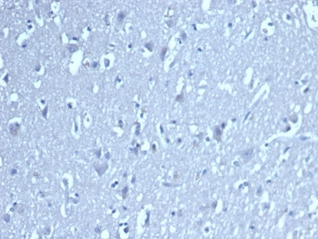 Negative control: IHC staining of human brain tissue with TCF1 alpha antibody at 2ug/ml. HIER: boil tissue sections in pH 9 10mM Tris with 1mM EDTA for 20 min and allow to cool before testing.