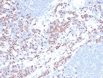 IHC staining of FFPE human lymph node cells (nuclear staining of non-germinal center) using TCF1 alpha antibody (clone LEF1/422R) at 2ug/ml.