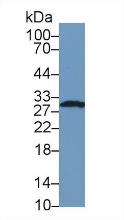 Western Blot; Sample: Human Hela cell lysate; <br/>Primary Ab: 1µg/ml Rabbit Anti-Mouse FKBP3 Antibody<br/>Second Ab: 0.2µg/mL HRP-Linked Caprine Anti-Rabbit IgG Polyclonal Antibody<br/>(Catalog: SAA544Rb19)