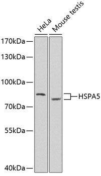 Anti-HSPA5 Antibody