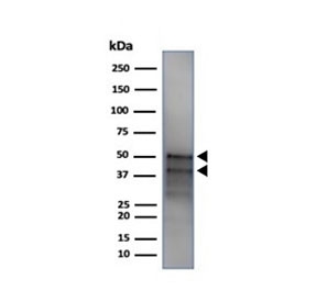 Western blot testing of human MCF7 cell lysate with recombinant GATA3 antibody (clone GATA3/4550R). Observed molecular weight: ~50 kDa (full length), ~37 kDa (splice form).