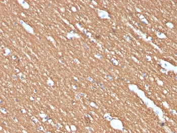 IHC staining of FFPE human brain with Myelin Basic Protein antibody (clone MBP/4274). HIER: boil tissue sections in pH 9 10mM Tris with 1mM EDTA for 20 min and allow to cool before testing.