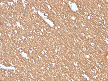 IHC staining of FFPE human brain with Myelin Basic Protein antibody (clone MBP/4274). HIER: boil tissue sections in pH 9 10mM Tris with 1mM EDTA for 20 min and allow to cool before testing.