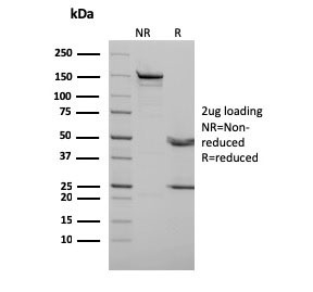 SDS-PAGE analysis of purified, BSA-free p73 antibody as confirmation of integrity and purity.