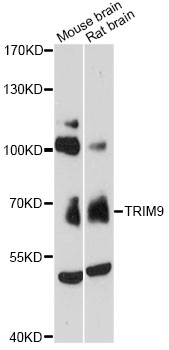 Anti-TRIM9 Antibody