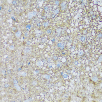 Anti-ATP1B2 Antibody