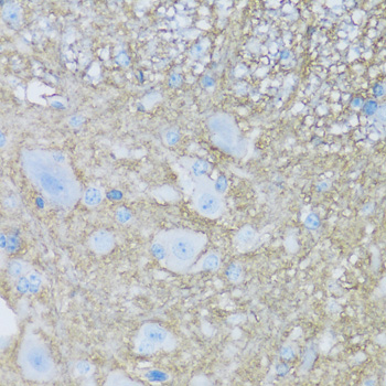 Anti-ATP1B2 Antibody