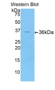 Western Blot; Sample: Recombinant ENA78, Human.