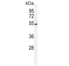 Western blot testing of human A549 cell lysate with Tyrosyl-DNA phosphodiesterase 2 antibody. Expected molecular weight: 41-51 kDa.