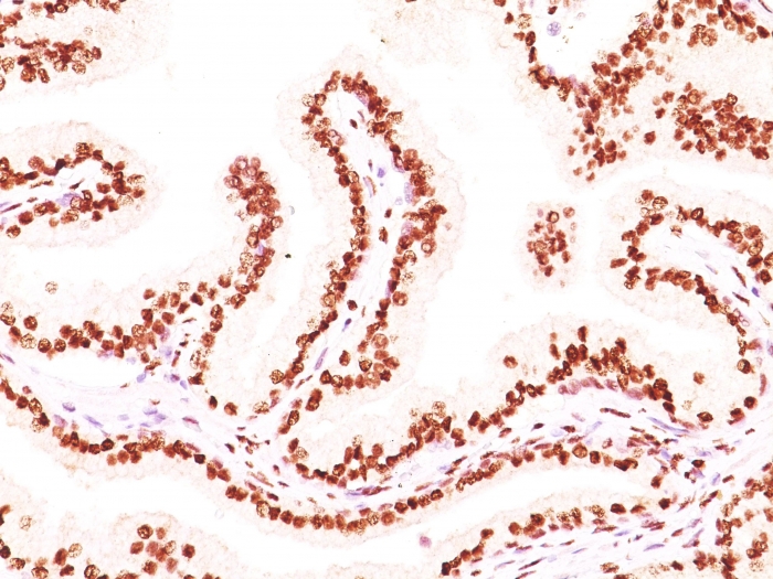 Anti-Androgen Receptor Antibody [AR441 + DHTR/882]