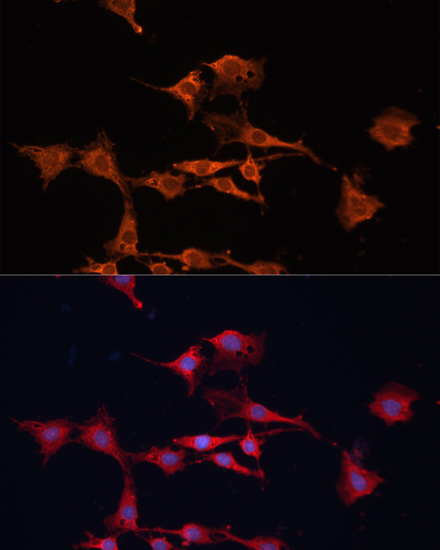 Anti-GSTM3 Antibody