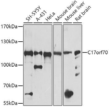 Anti-C17orf70 Antibody