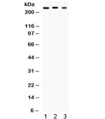 Western blot testing of 1) rat brain, 2) mouse brain and 3) U87 cell lysate with SCN1A antibody. Predicted molecular weight ~229 kDa but routinely observed at ~250 kDa.