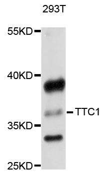 Anti-TTC1 Antibody