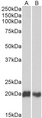 Anti-CD3D Antibody