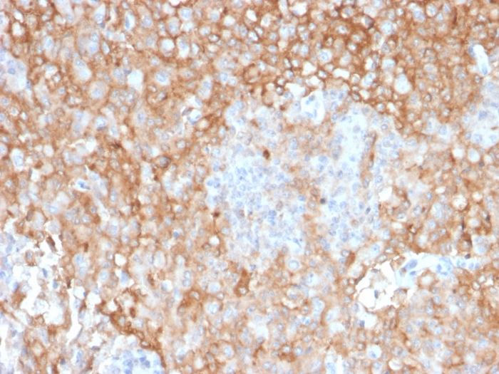 Anti-HLA DR Antibody [TAL 1B5]