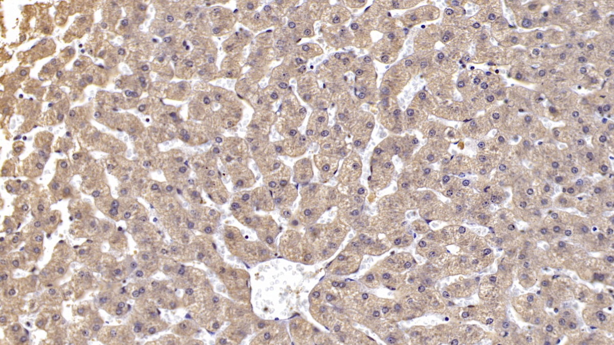 DAB staining on IHC-P; Sample: Human Liver Tissue;  Primary Ab: 10µg/ml Mouse Anti-Human Reelin Antibody Second Ab: 2µg/mL HRP-Linked Caprine Anti-Mouse IgG Polyclonal Antibody (Catalog: SAA544Mu19)