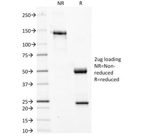 SDS-PAGE Analysis of Purified, BSA-Free Phosphotyrosine Antibody (clone PY20). Confirmation of Integrity and Purity of the Antibody.