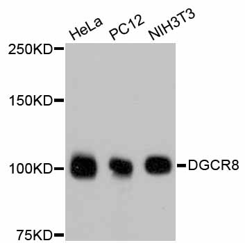 Anti-DGCR8 Antibody [Assigned #A11404]