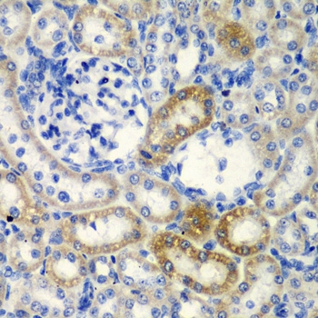 Anti-DCTD Antibody