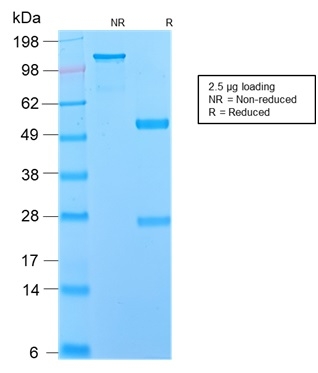 Anti-p75 NGF Receptor Antibody [NGFR/2550R] - BSA and Azide free