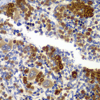 Anti-PRKAB1 Antibody
