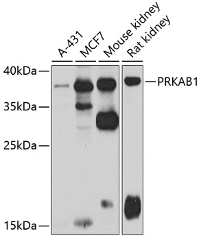 Anti-PRKAB1 Antibody