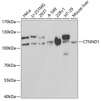 Anti-CTNND1 Antibody