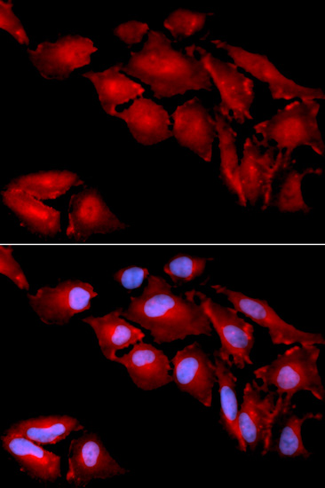 Anti-CTNND1 Antibody