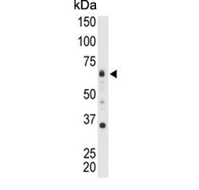 Western blot testing of mouse heart tissue lysate with MTMR9 antibody. Predicted molecular weight ~63 kDa.