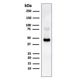 Western blot testing of human Raji cell lysate with recombinant CD38 antibody. Expected molecular weight: 34-46 kDa.