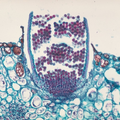 Puccinia graminis Aecia sec., 12 µm Microscope Slide
