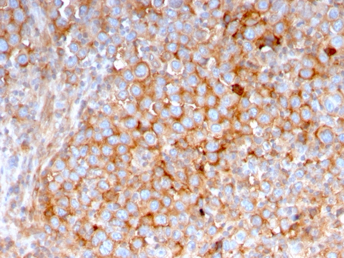 Anti-SERBP1 Antibody [SERBP1/3495]