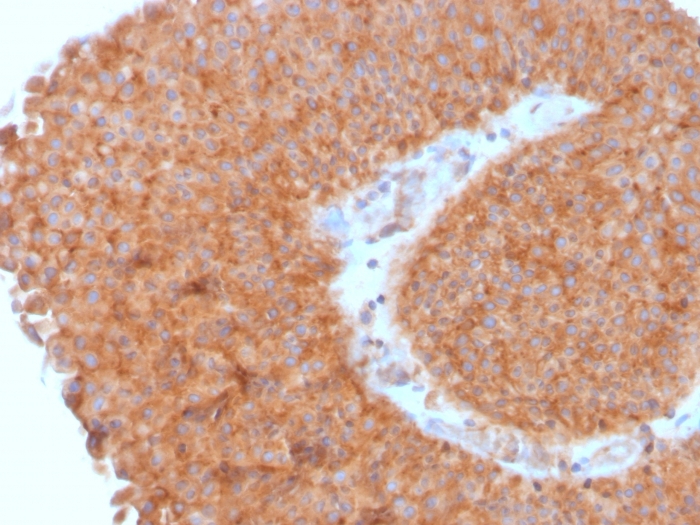 Anti-SERBP1 Antibody [SERBP1/3495]