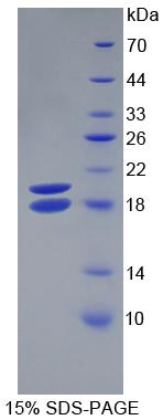 Figure. SDS-PAGE