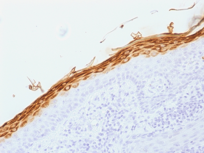 Anti-Filaggrin Antibody [FLG/1562]