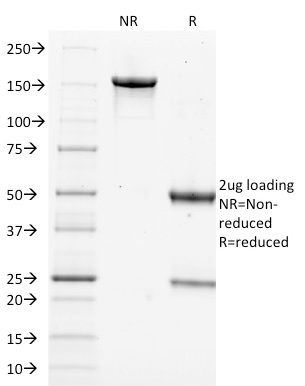 Anti-Filaggrin Antibody [FLG/1562]
