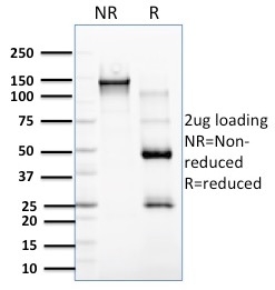 Anti-RCAS1 Antibody [CPTC-EBAG9-2]