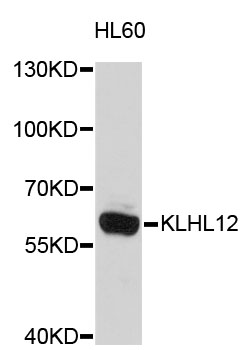 Anti-KLHL12 Antibody