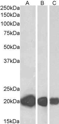 Anti-CSRP3 Antibody